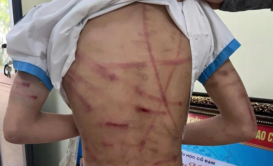 Cháu bé kêu cứu, người dân phát hiện